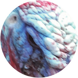 Wattle (LP Picture Disc)