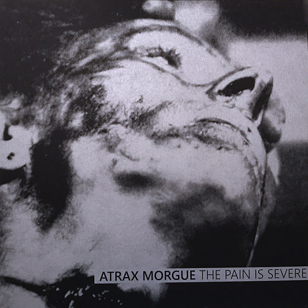 Atrax Morgue – The Pain Is Severe – Soundohm
