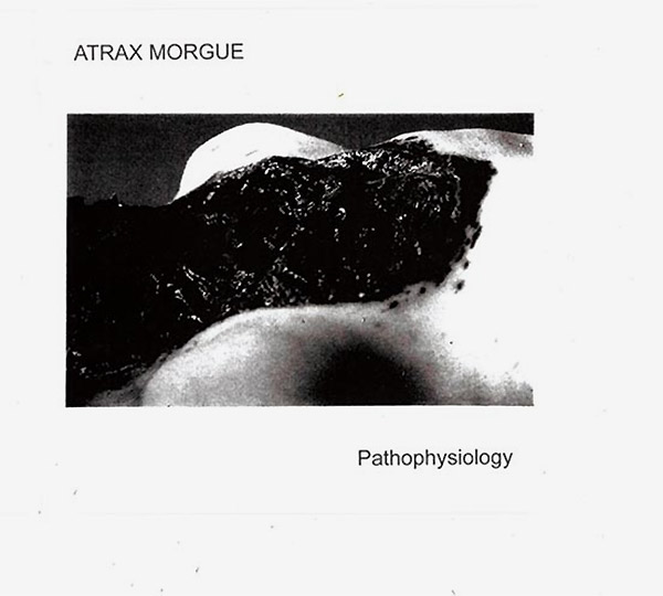 Atrax Morgue – Pathophysiology – Soundohm