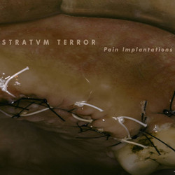 Pain Implantations